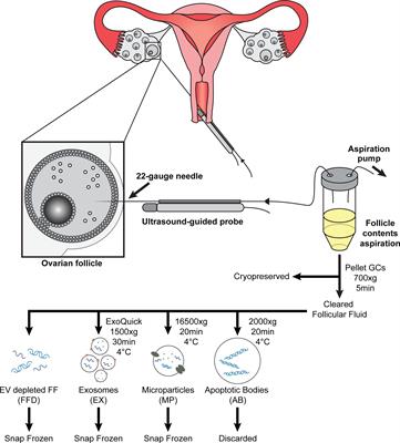 Obesity and PCOS radically alters the snRNA composition of follicular fluid extracellular vesicles